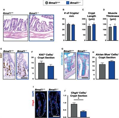 BMAL1 Regulates the Daily Timing of Colitis